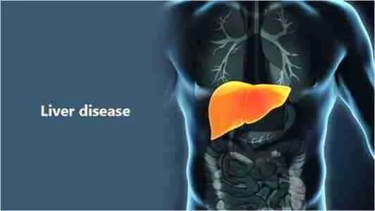 liver-disease