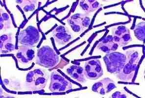 Gram-positive bacteria