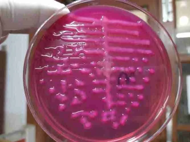 Klebsiella-Oxytoca-667x500.jpg