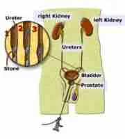 Ureteroscope