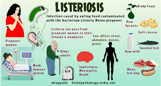 Listeriosis 