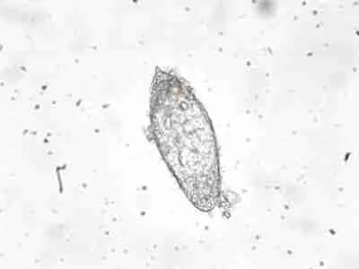 schistosoma haematobium