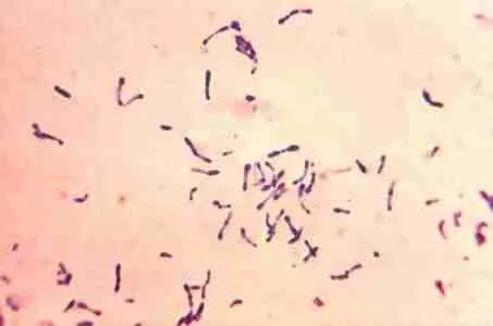 corynebacterium diphtheriae