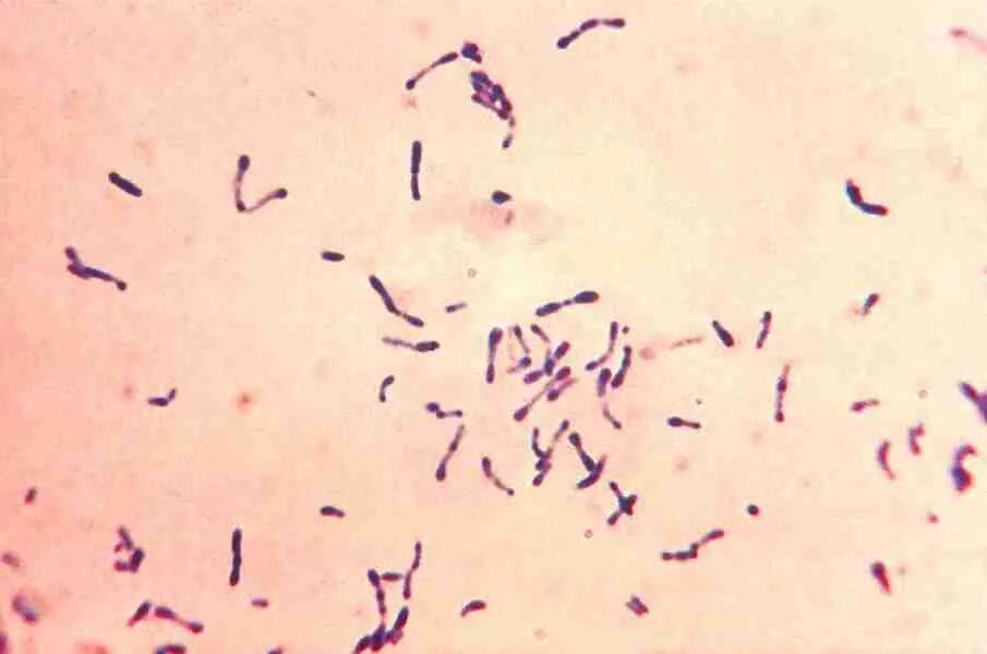 corynebacterium diphtheriae