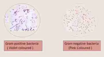 Gram Staining