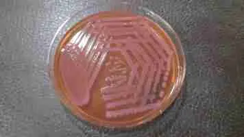 acinetobacter